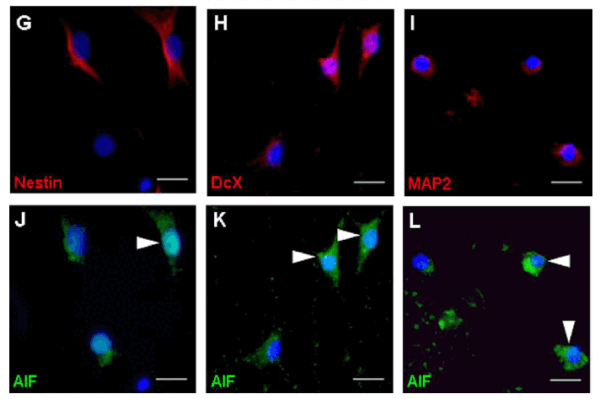 ICC/IF rabbit anti aif in polyclonal antibody 5823