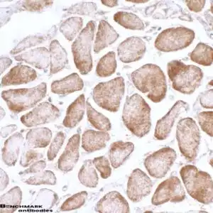 IHC rabbit anti ampk alpha 1 polyclonal antibody 9481