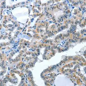 IHC rabbit anti angiotensin converting enzyme 2 ace2 polyclonal antibody 5362