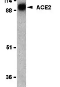 Western blot rabbit anti angiotensin converting enzyme 2 ace2 polyclonal antibody 7437