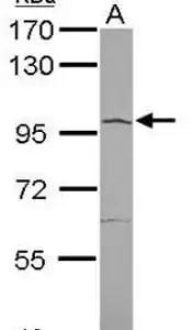 Western blot rabbit anti angiotensin converting enzyme 2 ace2 polyclonal antibody 7593