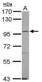 Western blot rabbit anti angiotensin converting enzyme 2 ace2 polyclonal antibody 7593
