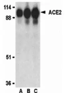 Western blot rabbit anti angiotensin converting enzyme 2 ace2 polyclonal antibody 7888