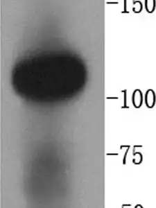 Western blot rabbit anti angiotensin converting enzyme 2 ace2 polyclonal antibody 8113