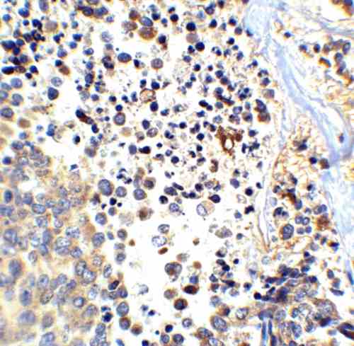 IHC rabbit anti app abeta nt polyclonal antibody 5729