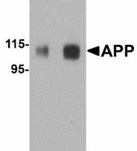 Western blot rabbit anti app ct polyclonal antibody 6788