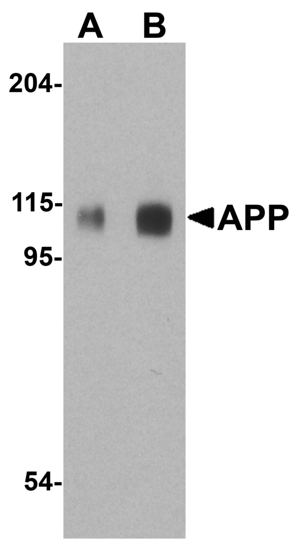 Western blot rabbit anti app ct polyclonal antibody 6788