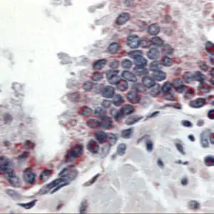 rabbit anti-APRIL (ED2) polyclonal antibody 9178