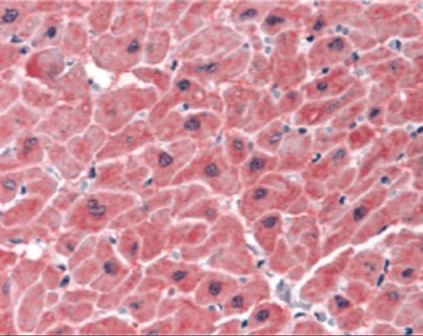 IHC rabbit anti arc ct polyclonal antibody 7023