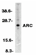 benchmark-antibodies_anti-arc_nt_antibody_8209_1.jpg