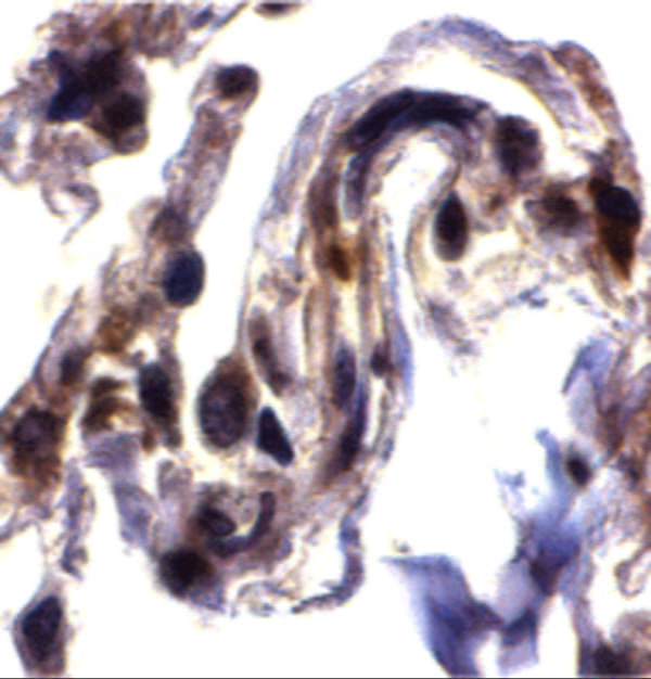 anti arts_antibody_1245_2.jpg