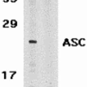 Western blot rabbit anti asc polyclonal antibody 1972