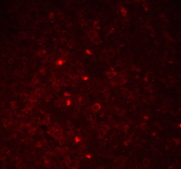 ICC/IF rabbit anti asc polyclonal antibody 1972