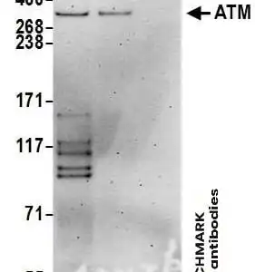 Western blot goat anti atm polyclonal antibody 1442