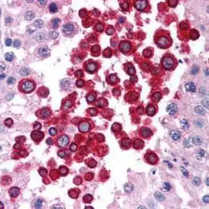 IHC mouse anti atm monoclonal antibody 2c1 2952