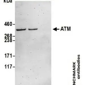 Western blot goat anti atm polyclonal antibody 4950
