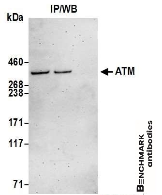 benchmark-antibodies_anti-atm_antibody_4950_1.jpg