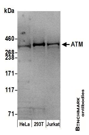 benchmark-antibodies_anti-atm_antibody_4950_2.jpg