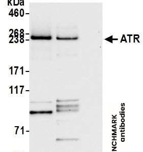 Western blot rabbit anti atr polyclonal antibody 8335