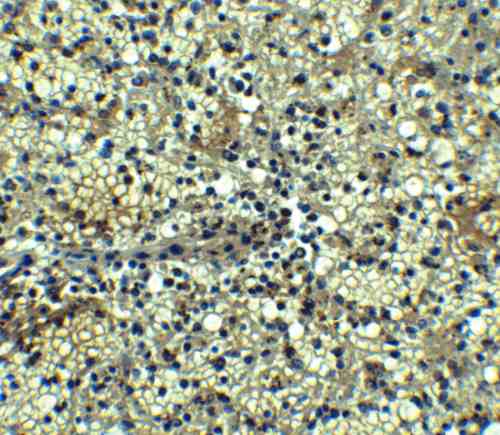 IHC rabbit anti bcma polyclonal antibody 4802