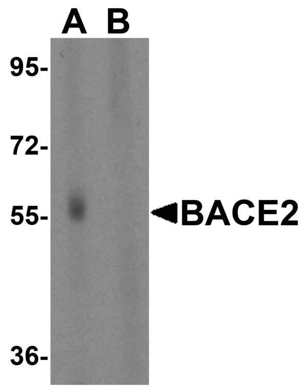 Western blot rabbit anti bace2 ct polyclonal antibody 4312