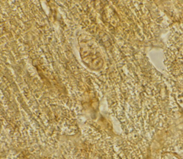 IHC rabbit anti bace2 ct polyclonal antibody 4312