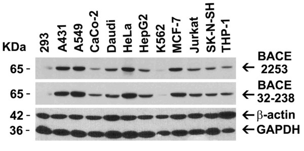 Western blot rabbit anti bace ct polyclonal antibody 7999