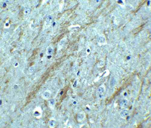 IHC rabbit anti bace ct polyclonal antibody 7999