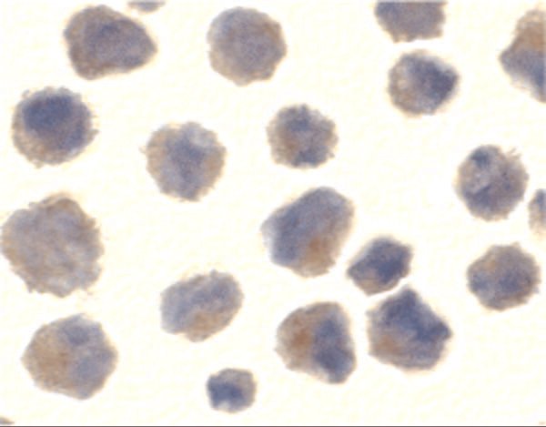 ICC/IF rabbit anti bace ct polyclonal antibody 7999