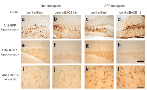 IHC rabbit anti bace ct polyclonal antibody 7999