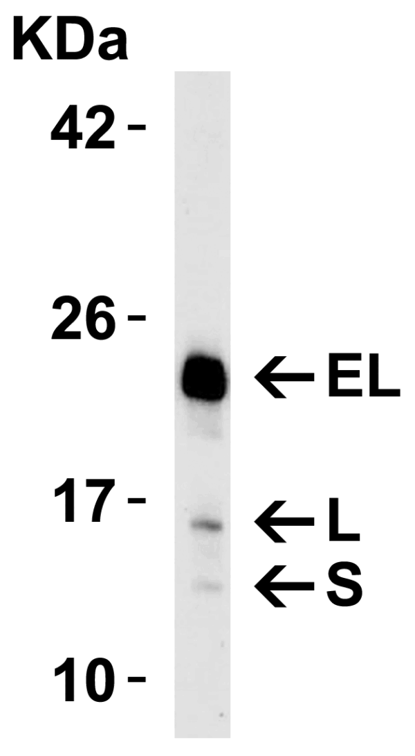 Western blot rabbit anti bim in polyclonal antibody 1410