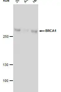 Western blot mouse anti brca1 monoclonal antibody 1d12 8112