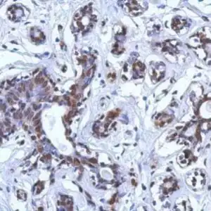 IHC mouse anti brca1 monoclonal antibody 3a2 9830