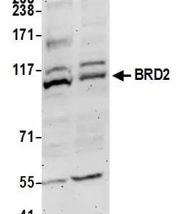 Western blot goat anti brd2 polyclonal antibody 8339