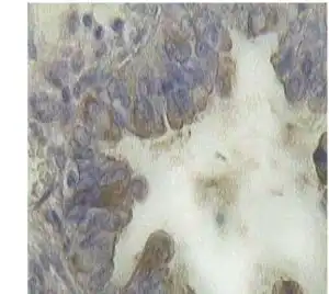 IHC mouse anti ca 125 monoclonal antibody 325 4754
