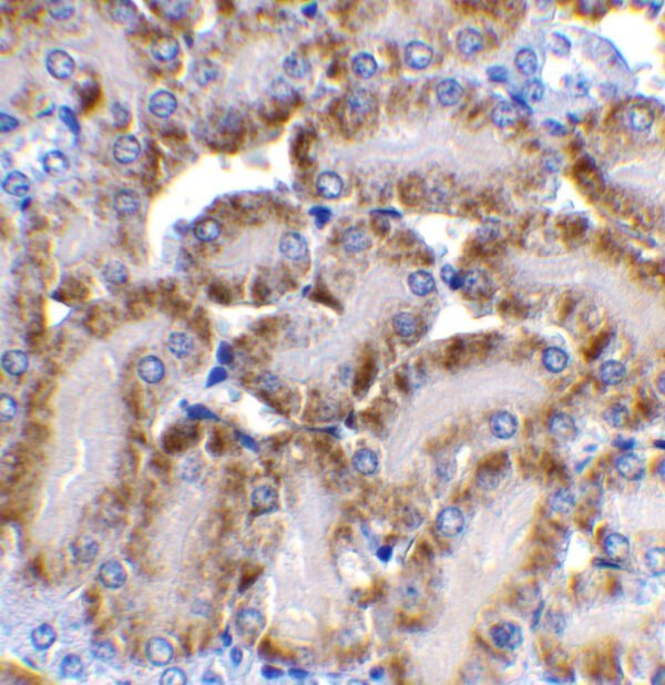 IHC rabbit anti cad 117 polyclonal antibody 6485