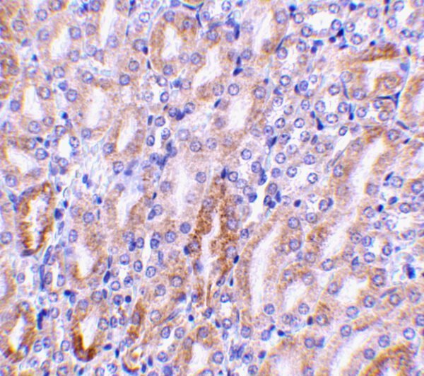 IHC rabbit anti cad ct polyclonal antibody 6973