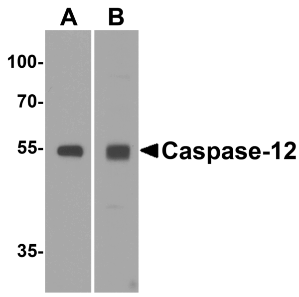 Western blot rabbit anti caspase 12 in polyclonal antibody 3322