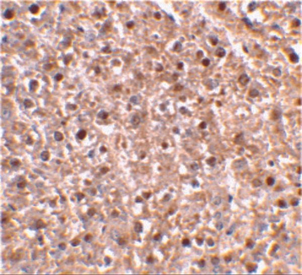 IHC rabbit anti caspase 12 in polyclonal antibody 3322