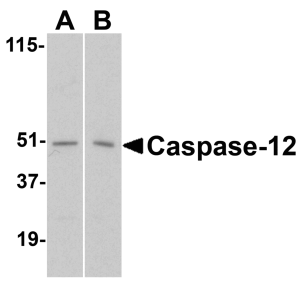 Western blot rabbit anti caspase 12 nt polyclonal antibody 8362