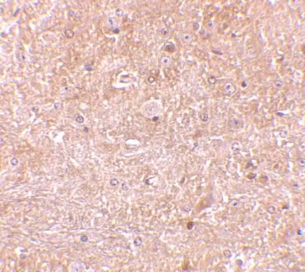 IHC rabbit anti caspase 13 polyclonal antibody 3345