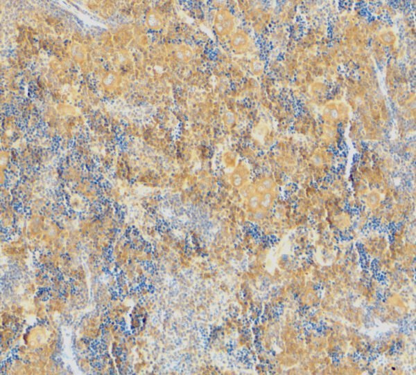 IHC rabbit anti caspase 4 antibody polyclonal antibody 7722