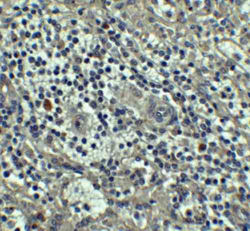 IHC rabbit anti caspase 8 antibody polyclonal antibody 2828