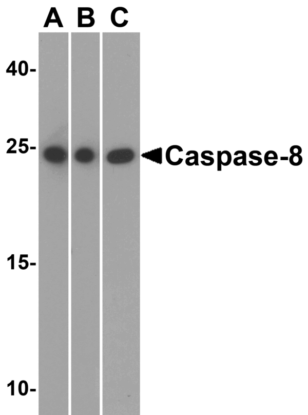 Western blot rabbit anti caspase 8 antibody polyclonal antibody 2828