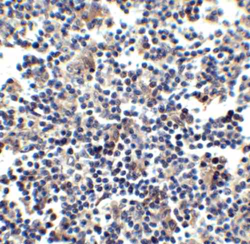 IHC rabbit anti ccr5 nt polyclonal antibody 8869