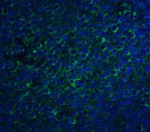 ICC/IF rabbit anti ccr5 nt polyclonal antibody 8869