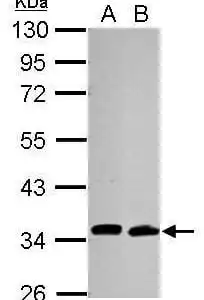 Western blot mouse anti cdc34 monoclonal antibody 14b5 7470
