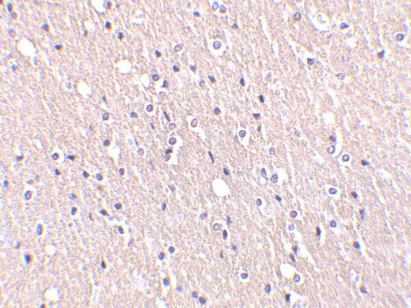 IHC rabbit anti cide a ct polyclonal antibody 3080