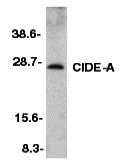 benchmark-antibodies_anti-cide-a_ct_antibody_5987_1.jpg