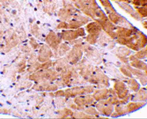 benchmark-antibodies_anti-cide-a_ct_antibody_5987_2.jpg